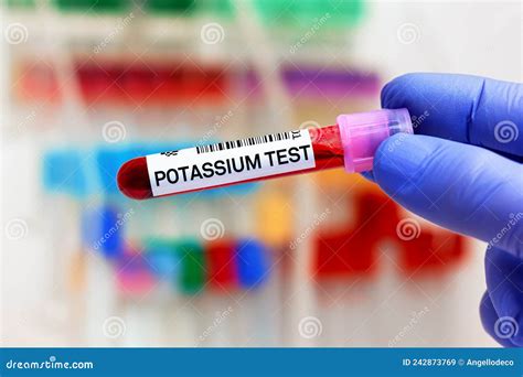 Potassium test Information 